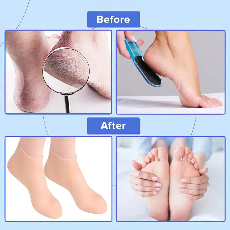Reusable Silicone Moisturizing Gel Socks (IMPORTED)