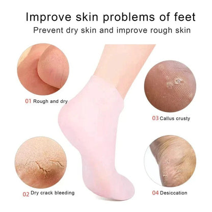 Reusable Silicone Moisturizing Gel Socks (IMPORTED)